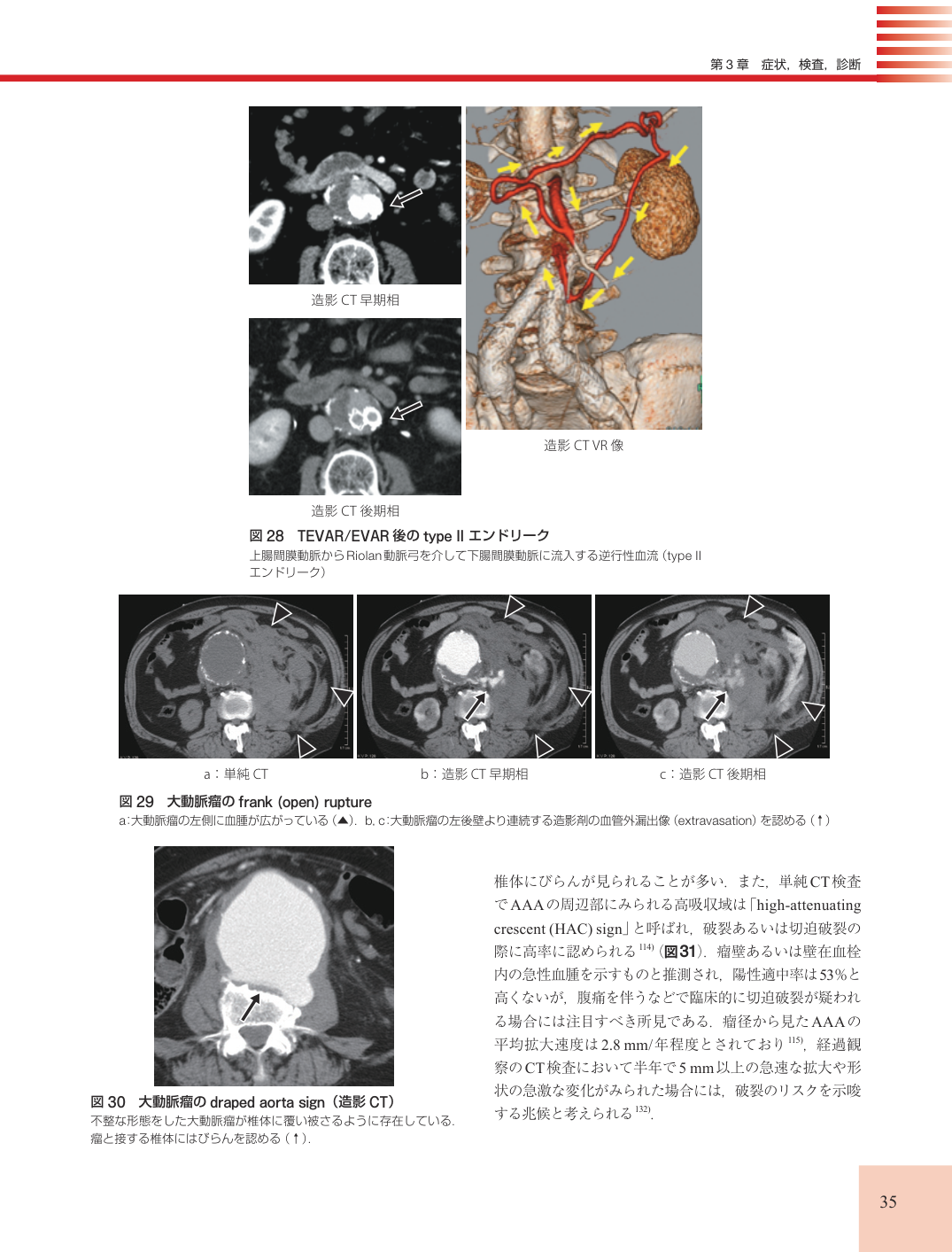p.35