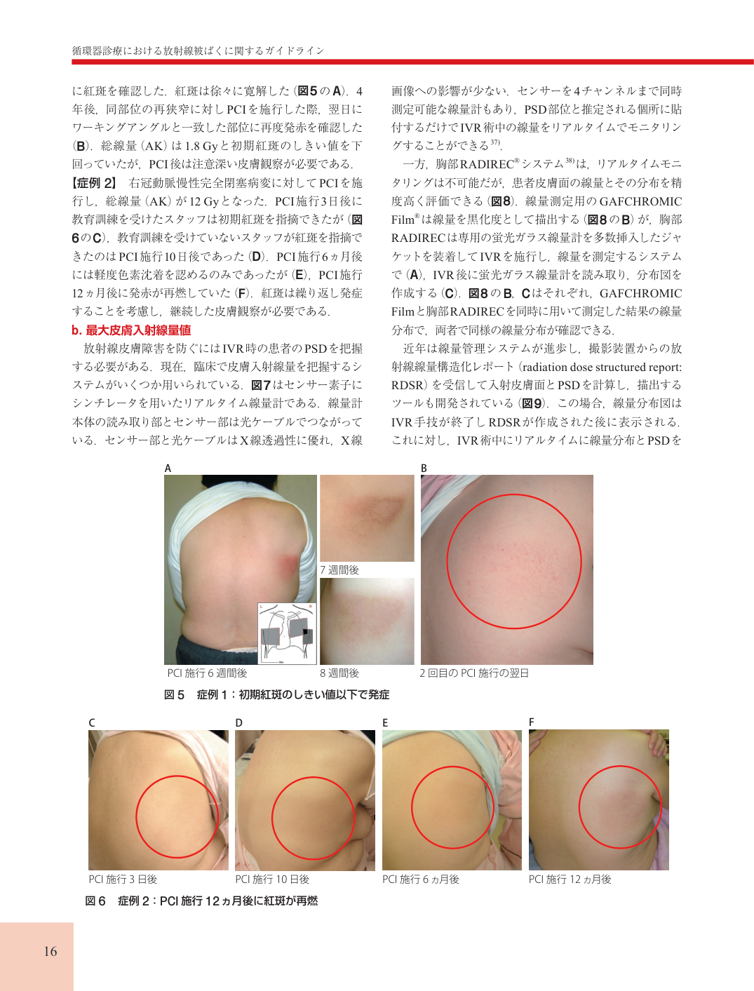 p.16