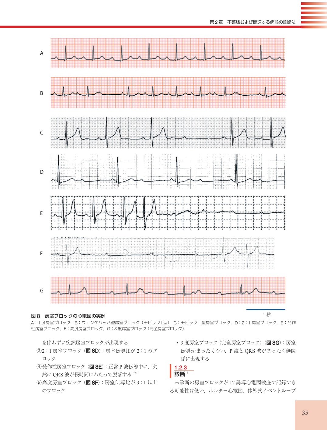 p.35