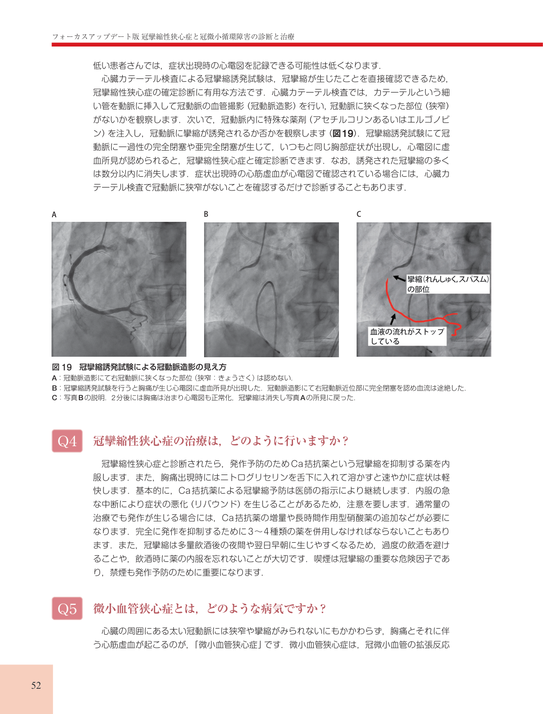 p.52