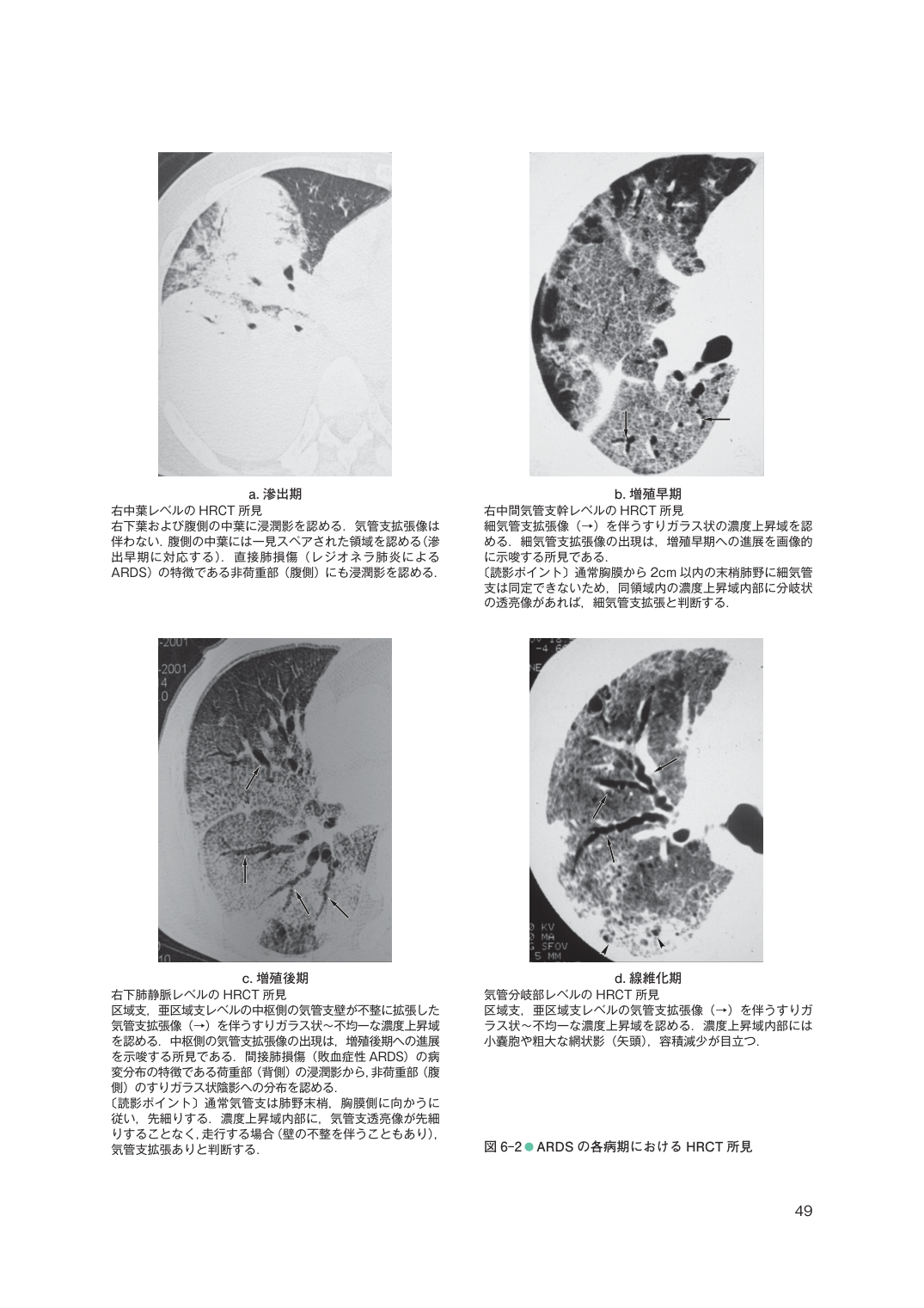 p.49