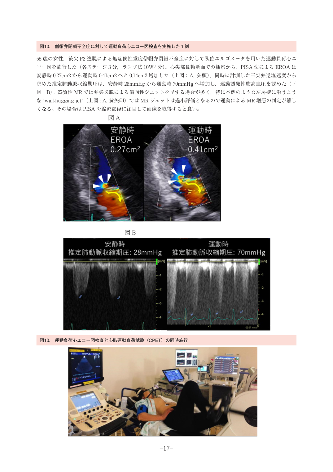 p.17